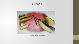 Mis Incision diapositivas técnica mis.pptx técnica de mínima incisión en lesiones de ...