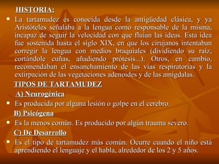 HISTORIA: La tartamudez es conocida desde la antigüedad clásica, y ya Aristóteles señalaba a la lengua como responsable de la misma, incapaz de seguir la velocidad con que fluían las ideas. Esta idea fue sostenida hasta el siglo XIX, en que los cirujanos intentaban corregir la lengua con medios braquiales (dividiendo su raíz, cortándole cuñas, añadiendo prótesis...). Otros, en cambio, recomendaban el ensanchamiento de las vías respiratorias y la extirpación de las vegetaciones adenoides y de las amígdalas. TIPOS DE TARTAMUDEZ A) Neurogénica Es producida por alguna lesión o golpe en el cerebro.  B) Psicógena Es la menos común. Es producido por algún trauma severo.  C) De Desarrollo Es el tipo de tartamudez más común. Ocurre cuando el niño está aprendiendo el lenguaje y el habla, alrededor de los 2 y 5 años .  
