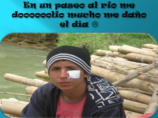 En un paseo al rio me doooooolio mucho me daño el día 