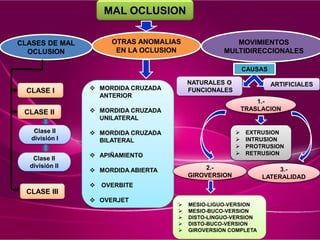 MAL OCLUSION
CLASES DE MAL
OCLUSION
OTRAS ANOMALIAS
EN LA OCLUSION
MOVIMIENTOS
MULTIDIRECCIONALES
 MORDIDA CRUZADA
ANTERIOR
 MORDIDA CRUZADA
UNILATERAL
 MORDIDA CRUZADA
BILATERAL
 APIÑAMIENTO
 MORDIDA ABIERTA
 OVERBITE
 OVERJET
NATURALES O
FUNCIONALES
ARTIFICIALES
1.-
TRASLACION
2.-
GIROVERSION
3.-
LATERALIDAD
 EXTRUSION
 INTRUSION
 PROTRUSION
 RETRUSION
 MESIO-LIGUO-VERSION
 MESIO-BUCO-VERSION
 DISTO-LINGUO-VERSION
 DISTO-BUCO-VERSION
 GIROVERSION COMPLETA.
CLASE I
CLASE II
CLASE III
Clase II
división I
Clase II
división II
CAUSAS
 