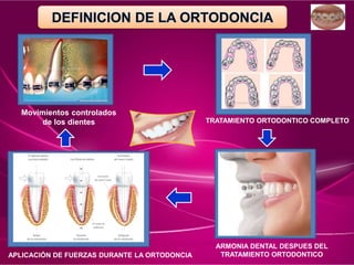 Movimientos controlados
de los dientes TRATAMIENTO ORTODONTICO COMPLETO
ARMONIA DENTAL DESPUES DEL
TRATAMIENTO ORTODONTICO
APLICACIÓN DE FUERZAS DURANTE LA ORTODONCIA
 