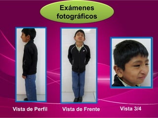 Exámenes
fotográficos
Vista de Perfil Vista de Frente Vista 3/4
 