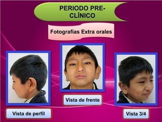 PERIODO PRE-
CLÍNICO
Fotografías Extra orales
Vista de perfil
Vista de frente
Vista 3/4
 