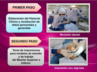 Revisión dental
Impresión con alginato
PRIMER PASO
Elaboración del Historial
Clínico y recolección de
datos personales y
generales
SEGUNDO PASO
Toma de impresiones
para modelos de estudio
y de trabajo
del Maxilar Superior e
Inferior
 