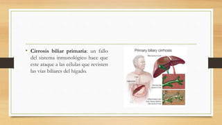 • Cirrosis biliar primaria: un fallo
del sistema inmunológico hace que
este ataque a las células que revisten
las vías biliares del hígado.
 