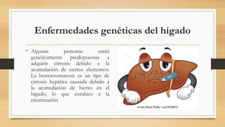 Enfermedades genéticas del hígado
• Algunas personas están
genéticamente predispuestas a
adquirir cirrosis debido a la
acumulación de ciertos elementos.
La hemocromatosis es un tipo de
cirrosis hepática causada debido a
la acumulación de hierro en el
hígado, lo que conduce a la
cicatrización
 