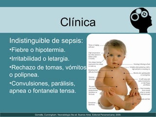 Clínica
Indistinguible de sepsis:
•Fiebre o hipotermia.
•Irritabilidad o letargia.
•Rechazo de tomas, vómitos
o polipnea.
•Convulsiones, parálisis,
apnea o fontanela tensa.
Gomella, Cunningham. Neonatología 5ta ed. Buenos Aires. Editorial Panamericana; 2009.
 