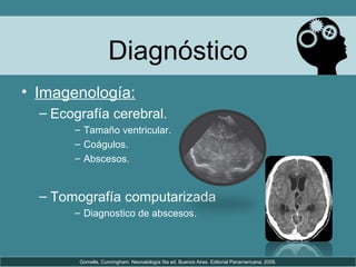 Diagnóstico
• Imagenología:
– Ecografía cerebral.
– Tamaño ventricular.
– Coágulos.
– Abscesos.
– Tomografía computarizada
– Diagnostico de abscesos.
Gomella, Cunningham. Neonatología 5ta ed. Buenos Aires. Editorial Panamericana; 2009.
 