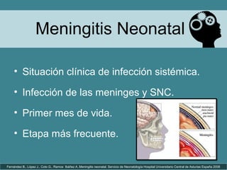 Meningitis Neonatal
• Situación clínica de infección sistémica.
• Infección de las meninges y SNC.
• Primer mes de vida.
• Etapa más frecuente.
Fernández B., López J., Coto G., Ramos Ibáñez A..Meningitis neonatal. Servicio de Neonatología Hospital Universitario Central de Asturias España 2008
 