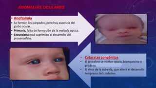 ANOMALÍAS OCULARES
• Anoftalmía
• Se forman los párpados, pero hay ausencia del
globo ocular.
• Primaria, falta de formación de la vesícula óptica.
• Secundaria está suprimido el desarrollo del
prosencéfalo,
• Cataratas congénitas
• El cristalino se vuelve opaco, blanquecina o
grisácea.
• El virus de la rubeola, que altera el desarrollo
temprano del cristalino
 