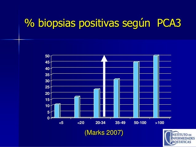 alto escolta masaje de próstata alto escolta masaje de próstata