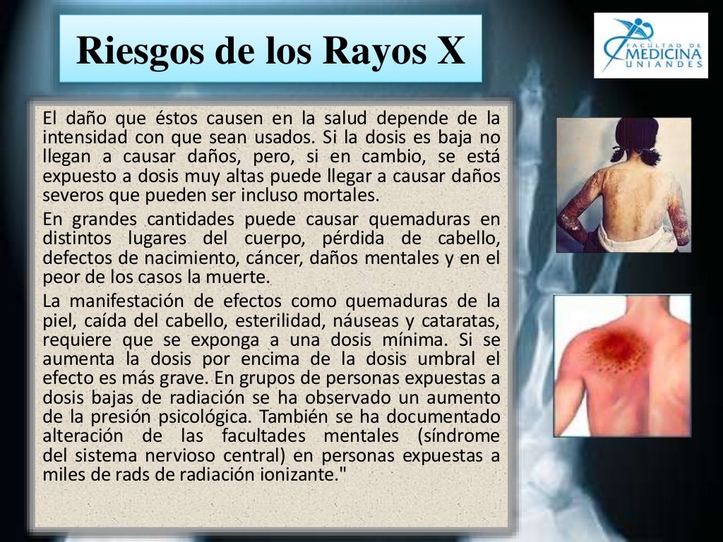 Historia de los Rayos X