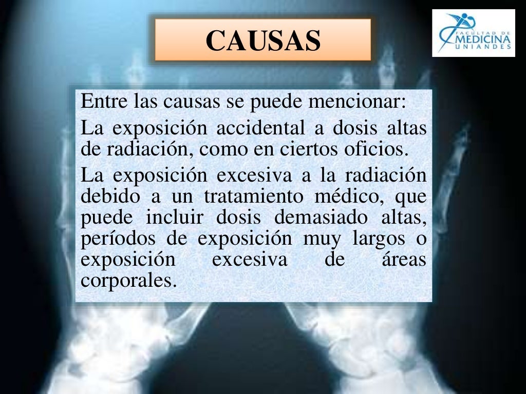 Historia de los Rayos X