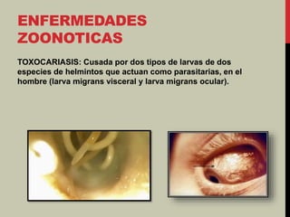 ENFERMEDADES
ZOONOTICAS
TOXOCARIASIS: Cusada por dos tipos de larvas de dos
especies de helmintos que actuan como parasitarias, en el
hombre (larva migrans visceral y larva migrans ocular).
 