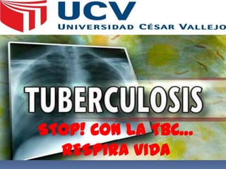 STOP! CON LA TBC…
RESPIRA VIDA
 