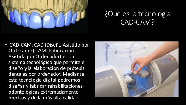 CAD-CAM