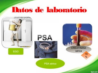 Datos de laboratorio
CREATININA
sérica
10
%
EGO
PSA sérico
 