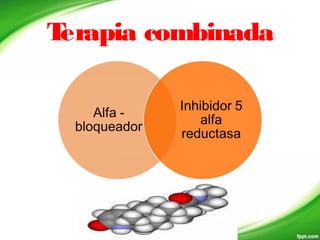 Terapia combinada
 
