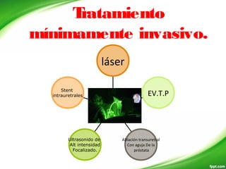 Tratamiento
mínimamente invasivo.
Stent
intrauretrales
Ultrasonido de
Alt intensidad
Focalizado.
Ablación transuretral
Con aguja De la
próstata
EV.T.P
láser
 