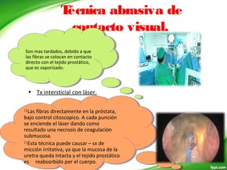 Técnica abrasiva de
contacto visual.
• Tx intersticial con láser.
Son mas tardados, debido a que
las fibras se colocan en contacto
directo con el tejido prostático,
que es vaporizado.
Son mas tardados, debido a que
las fibras se colocan en contacto
directo con el tejido prostático,
que es vaporizado.
Las fibras directamente en la próstata,
bajo control citoscopico. A cada punción
se enciende el láser dando como
resultado una necrosis de coagulación
submucosa.
Esta técnica puede causar – sx de
micción irritativa, ya que la mucosa de la
uretra queda intacta y el tejido prostático
es reabsorbido por el cuerpo.
Las fibras directamente en la próstata,
bajo control citoscopico. A cada punción
se enciende el láser dando como
resultado una necrosis de coagulación
submucosa.
Esta técnica puede causar – sx de
micción irritativa, ya que la mucosa de la
uretra queda intacta y el tejido prostático
es reabsorbido por el cuerpo.
 