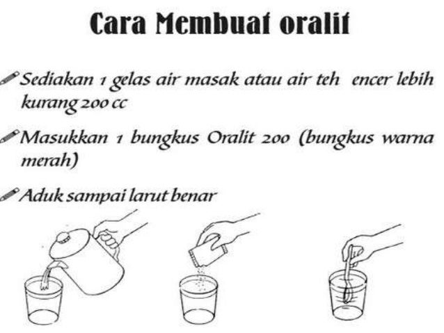 Cara Membuat Oralit Gula Garam | cara membuat oralit gula garam diare pneumonia Cara Membuat Oralit Gula Garam | cara membuat oralit gula garam diare pneumonia
