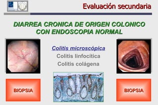 Evaluación secundaria DIARREA CR O NICA DE ORIGEN COL O NICO CON ENDOSCOPIA NORMAL Colitis microscópica Colitis linfocítica Colitis colágena BIOPSIA BIOPSIA 