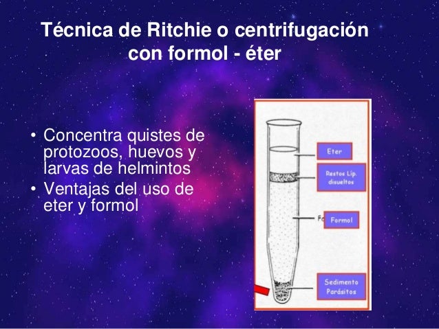 El medio de las lombrices spb