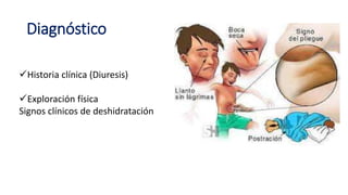 Diagnóstico
Historia clínica (Diuresis)
Exploración física
Signos clínicos de deshidratación
 