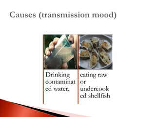 Drinking
contaminat
ed water.
eating raw
or
undercook
ed shellfish
 