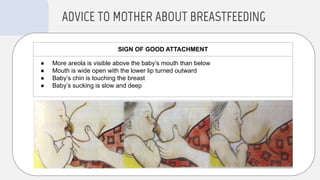 ADVICE TO MOTHER ABOUT BREASTFEEDING
SIGN OF GOOD ATTACHMENT
● More areola is visible above the baby’s mouth than below
● Mouth is wide open with the lower lip turned outward
● Baby’s chin is touching the breast
● Baby’s sucking is slow and deep
 