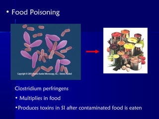 • Food Poisoning
Clostridium perfringens
• Multiplies in food
•Produces toxins in SI after contaminated food is eaten
 