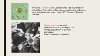 Immature E. histolytica in a concentrated wet mount stained
with iodine. This early cyst has only one nucleus and a glycogen
mass is visible (brown stain). From CDC’s Division of Parasitic
Diseases
Giardia intestinalis on small
intestinal mucosa. (Courtesy of Dr A
Phillips, Department of Electron
Microscopy,
Royal Free Hospital, London.)
 