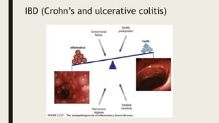 IBD (Crohn’s and ulcerative colitis)
 