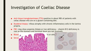 Investigation of Coeliac Disease
■ Anti-tissue transglutaminase (TTG):positive in about 98% of patients with
celiac disease who are on a gluten-containing diet.
■ Duodenal biopsy: villous atrophy with chronic inflammatory cells in the lamina
propria.
■ FBC: may show anaemia (folate or iron deficiency – vitamin B12 deficiency is
rare as the stomach and terminal ileum are not involved).
■ Blood film may show Howell–Jolly bodies or other signs of hyposplenism.
■ Serum albumin: hypoalbuminaemia
 