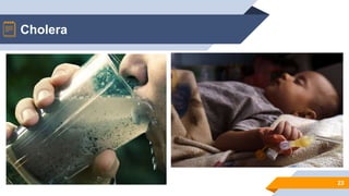23
Cholera
 