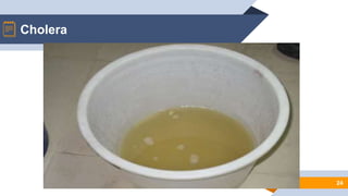 24
Cholera
 