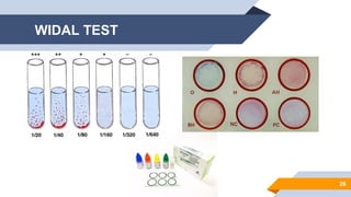 WIDAL TEST
26
 