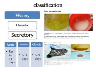 Comprehensive Management of Acute Watery Diarrhea in Children Under ...