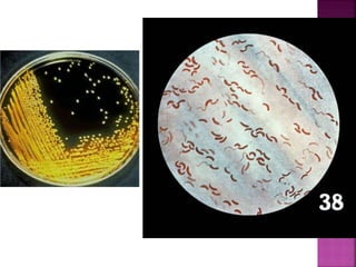 Microbiological Aspects Of Diarrhoea | PPTX