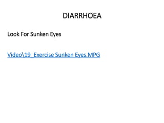 Look For Sunken Eyes
Video19_Exercise Sunken Eyes.MPG
DIARRHOEA
DIARRHOEA
 