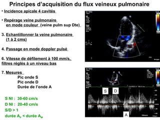 Principes d’acquisition du flux veineux pulmonaire Incidence apicale 4 cavités  Repérage veine pulmonaire  en mode couleur  (veine pulm sup Dte)   3.  Echantillonner la veine pulmonaire  (1 à 2 cms) 4.  Passage en mode doppler pulsé  6.  Vitesse de défilement à 100 mm/s,  filtres réglés à un niveau bas 7 .  Mesures  Pic onde S Pic onde D  Durée de l’onde A S Nl :  30-60 cm/s D Nl :  20-40 cm/s  S/D > 1  durée A P  < durée A M S D A 