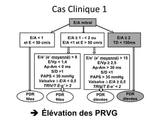    Élévation  des PRVG E/A mitral E/A < 1  et E < 50 cm/s E/A ≥ 1 - < 2 ou  E/A <1 et E > 50 cm/s  E/A ≥ 2  TD < 150ms E/e’ (e’  moyenné ) < 8 E/Vp < 1,4 Ap-Am < 0 ms S/D >1 PAPS < 30 mmHg Valsalva ∆ E/A < 0,5 TRIV/T E-e’ > 2 E/e’ (e’  moyenné ) > 15 E/Vp ≥ 2,5 Ap-Am > 30 ms S/D <1 PAPS > 35 mmHg Valsalva ∆ E/A ≥ 0,5 TRIV/T E-e’ < 2 PDR Nles PDR élevées PDR Nles PDR élevées Cas Clinique 1 
