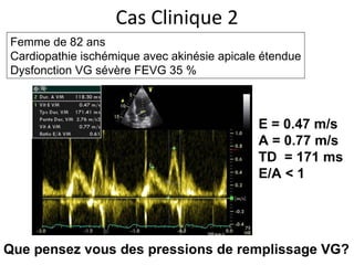 Femme de 82 ans Cardiopathie ischémique avec akinésie apicale étendue Dysfonction VG sévère FEVG 35 % Cas Clinique 2 Que pensez vous des pressions de remplissage VG? E = 0.47 m/s A = 0.77 m/s TD  = 171 ms E/A < 1 
