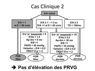    Pas d’élévation des PRVG E/A mitral E/A < 1  et E < 50 cm/s E/A ≥ 1 - < 2 ou  E/A <1 et E > 50 cm/s  E/A ≥ 2  TD < 150ms E/e’ (e’  moyenné ) < 8 E/Vp < 1,4 Ap-Am < 0 ms S/D >1 PAPS < 30 mmHg Valsalva ∆ E/A < 0,5 TRIV/T E-e’ > 2 E/e’ (e’  moyenné ) > 15 E/Vp ≥ 2,5 Ap-Am > 30 ms S/D <1 PAPS > 35 mmHg Valsalva ∆ E/A ≥ 0,5 TRIV/T E-e’ < 2 PDR Nles PDR élevées PDR Nles PDR élevées Cas Clinique 2 