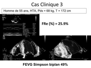 FEVG Simpson biplan 49% Cas Clinique 3 FRe (%) = 25.9% Homme de 55 ans, HTA,  Pds = 68 kg, T = 172 cm 