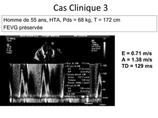 Cas Clinique 3 Homme de 55 ans, HTA,  Pds = 68 kg, T = 172 cm  FEVG préservée E = 0.71 m/s A = 1.38 m/s TD = 129 ms 