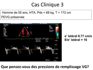 Cas Clinique 3 e’ latéral 8.77 cm/s E/e’ latéral = 16 Homme de 55 ans, HTA,  Pds = 68 kg, T = 172 cm FEVG préservée Que pensez-vous des pressions de remplissage VG? 