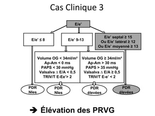 E/e’ E/e’ ≤ 8  E/e’ 9-13  E/e’ septal ≥ 15 Ou E/e’ latéral ≥ 12 Ou E/e’ moyenné ≥ 13 Volume OG < 34ml/m² Ap-Am < 0 ms PAPS < 30 mmHg Valsalva ∆ E/A < 0,5 TRIV/T E-Ee’> 2 Volume OG ≥ 34ml/m² Ap-Am > 30 ms PAPS > 35 mmHg Valsalva ∆ E/A ≥ 0,5 TRIV/T E-e’ < 2 PDR Nles PDR élevées PDR Nles PDR élevées Cas Clinique 3    Élévation  des PRVG 