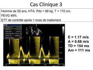 Cas Clinique 3 Homme de 55 ans, HTA,  Pds = 68 kg, T = 172 cm,  FEVG 49% ETT de contrôle après 1 mois de traitement E = 1.17 m/s A = 0.68 m/s TD = 154 ms Am = 111 ms 