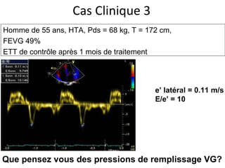 Cas Clinique 3 Homme de 55 ans, HTA,  Pds = 68 kg, T = 172 cm,  FEVG 49% ETT de contrôle après 1 mois de traitement e’ latéral = 0.11 m/s E/e’ = 10 Que pensez vous des pressions de remplissage VG? 